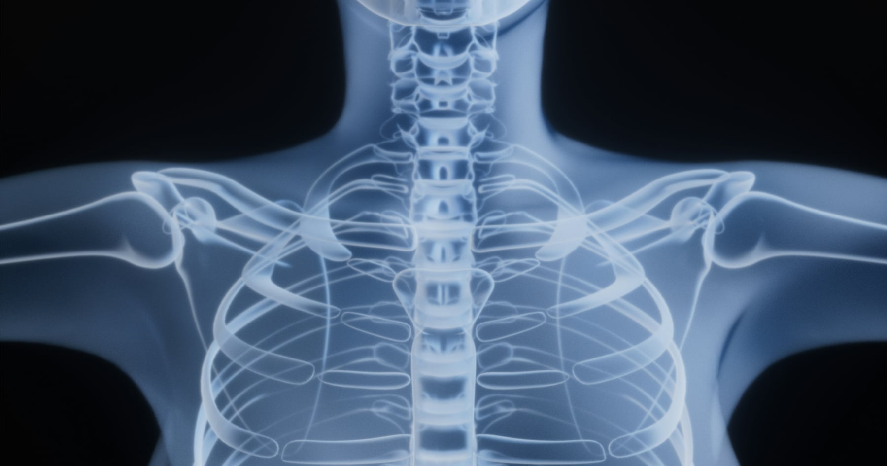 Understanding Soft Tissue Injuries after a San Antonio Car Accident