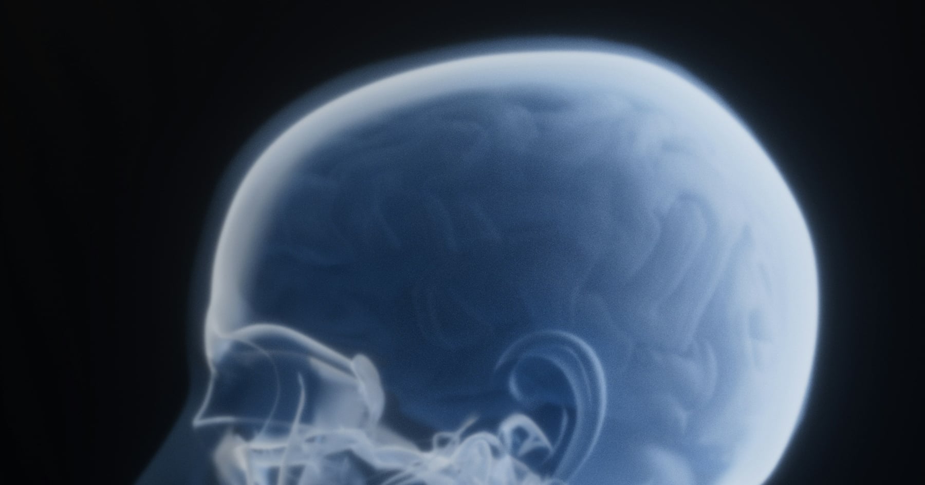 What Is A Herniated Disc Injury?
