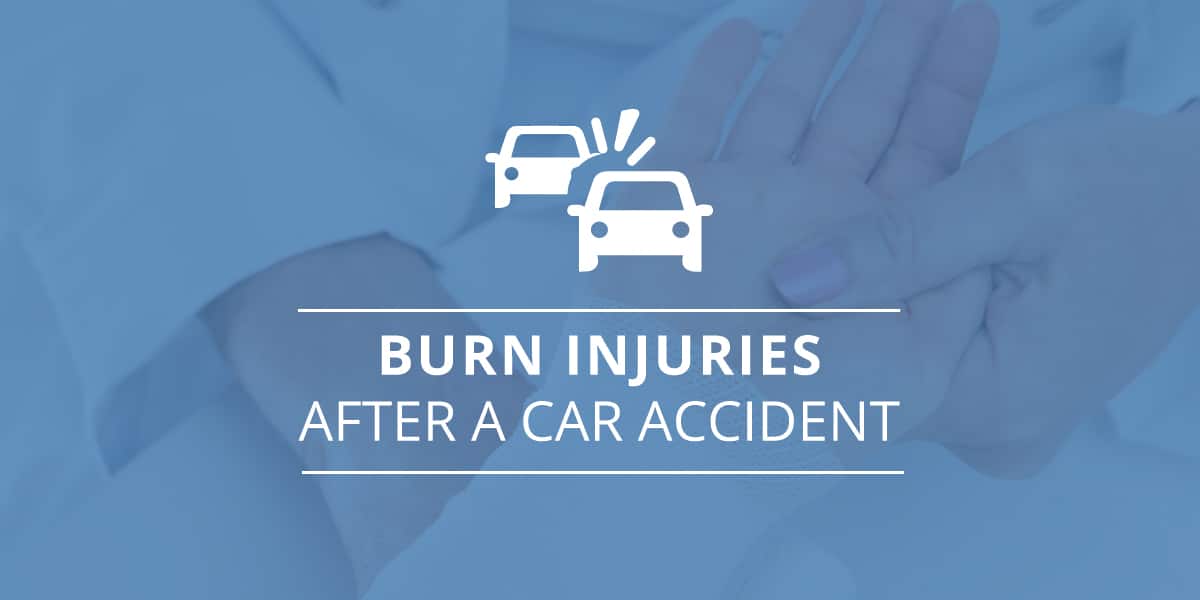 Burn Injuries After A Car Accident