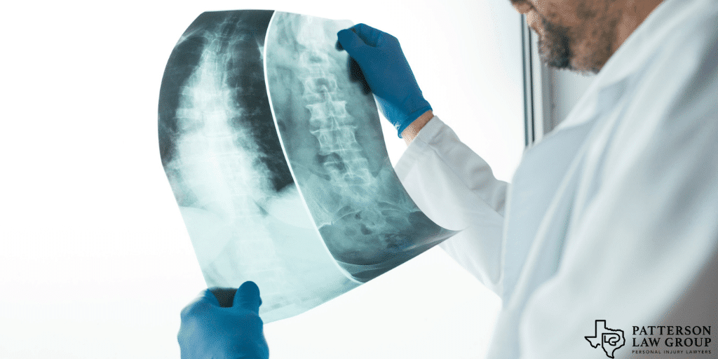 Fort Worth Texas neck injury lawyers